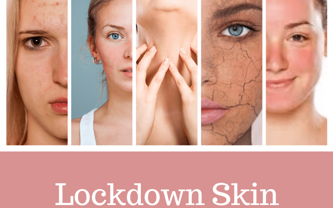Lockdown Skin